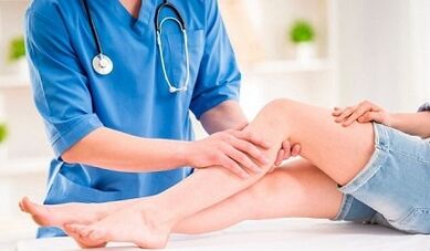 Cómo tratar las venas varicosas en las piernas